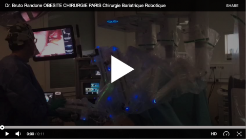 Dr. Bruto Randone, Chirurgien Digestif et Bariatrique | OBESITE CHIRURGIE PARIS | CHIRURGIE DIGESTIVE PARIS 
